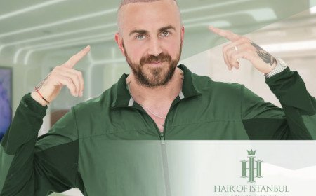   HAIR OF ISTANBUL ISSUES GUIDE TO COMPARING HAIR TRANSPLANT PACKAGES IN TÜRKIYE
